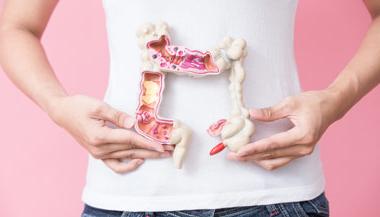 一名女子拿着塑料肠子模型炫耀结直肠癌
