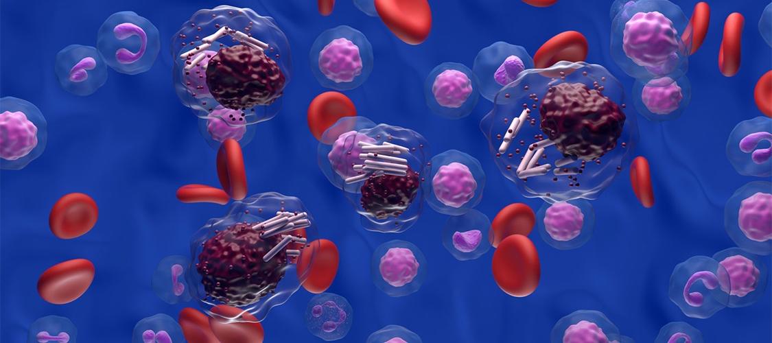 Digital illustration of lymphocytic leukemia cells in the blood stream.