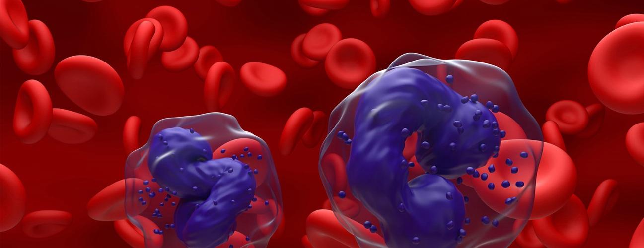 Digital illustration of myelogenous leukemia cells i the blood stream.