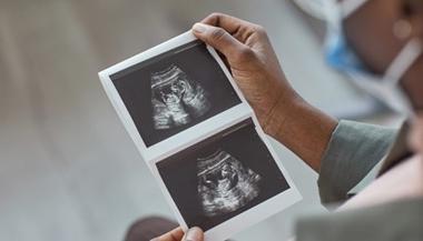 准父母拿着胎儿超声图像