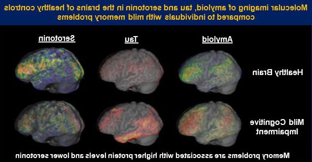 Molecular imaging of amyloid, tau, and serotonin in the brain of healthy controls compared to individuals with mild congitive problems